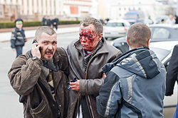 Wounded Minsk blast 2.jpg